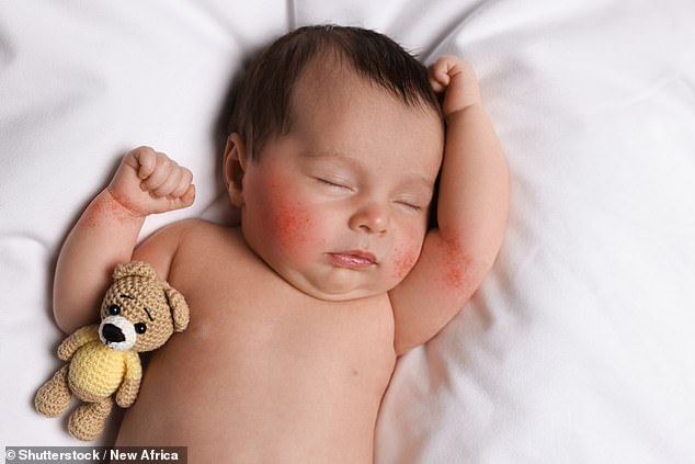 Dr.  Meso warns that you should watch out for drowsiness, rash, high temperature and rapid breathing in newborns as these could be a sign of an infection.