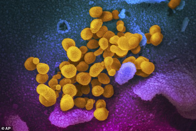 The photo shows the coronavirus, indicated in yellow, emerging from the surface of cells, indicated in blue/pink, grown in a laboratory.  Research shows that the virus can revive dormant cancer cells and cause inflammation throughout the body that can lead to the proliferation of cancer cells.