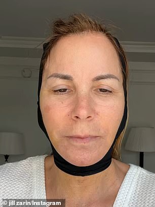 RHONY alumna Jill Zarin's plastic surgeon talks about the work she recently had done on her face;  pictured after her surgery earlier in June