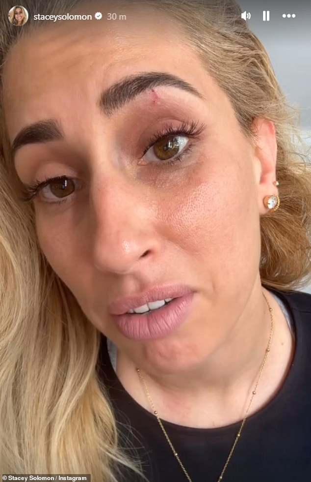 Stacey Solomon gave herself a black eye while trying to build a chicken coop for her new ducklings, she revealed on Instagram on Tuesday