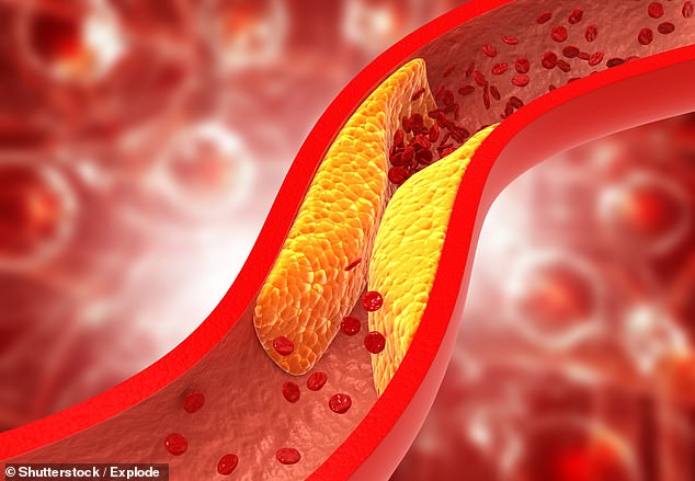 Cholesterol is a fatty substance that can build up and damage the blood vessels that supply blood to the heart.  It is found in animal products, such as meat and egg yolks