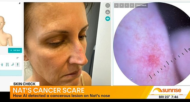 Natalie Barr, 56, (pictured) shocked Sunrise viewers on Tuesday morning when she revealed her recent skin cancer diagnosis
