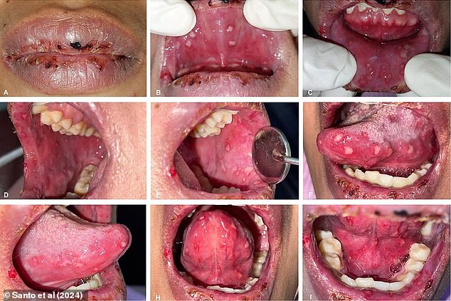 Above are photos from the patient's case report showing her condition when she first visited the doctors