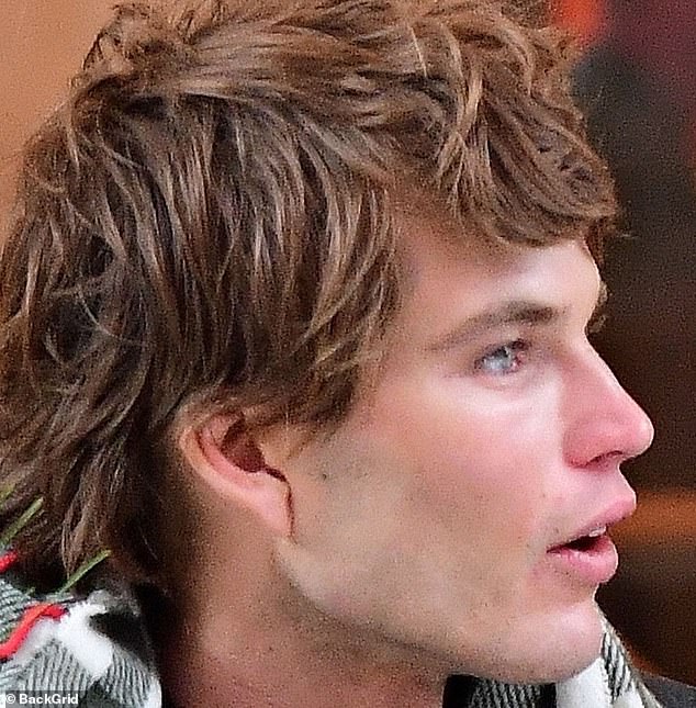 Leading Sydney plastic surgeon Dr Naomi McCullum has put forward an interesting theory about the cause of Jordan Barrett's unusual ear scar after the Australian supermodel, 27, (pictured) was spotted in London last weekend with a loose-looking ear lobe .
