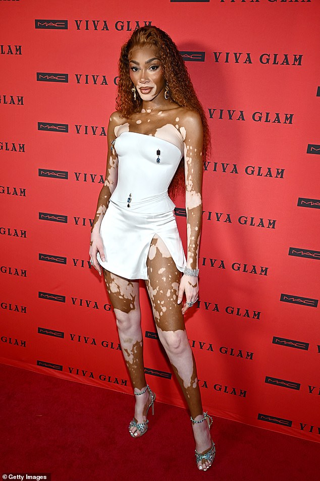 Winnie Harlow made sure all eyes were on her at the Viva Glam Billion Dollar Ball in New York City on Wednesday