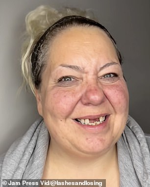 Sarah Andres, from Alberta, Canada, shares how easily she can transform her appearance with the help of carefully applied cosmetics and clip-in veneers.  In the photo: in the past