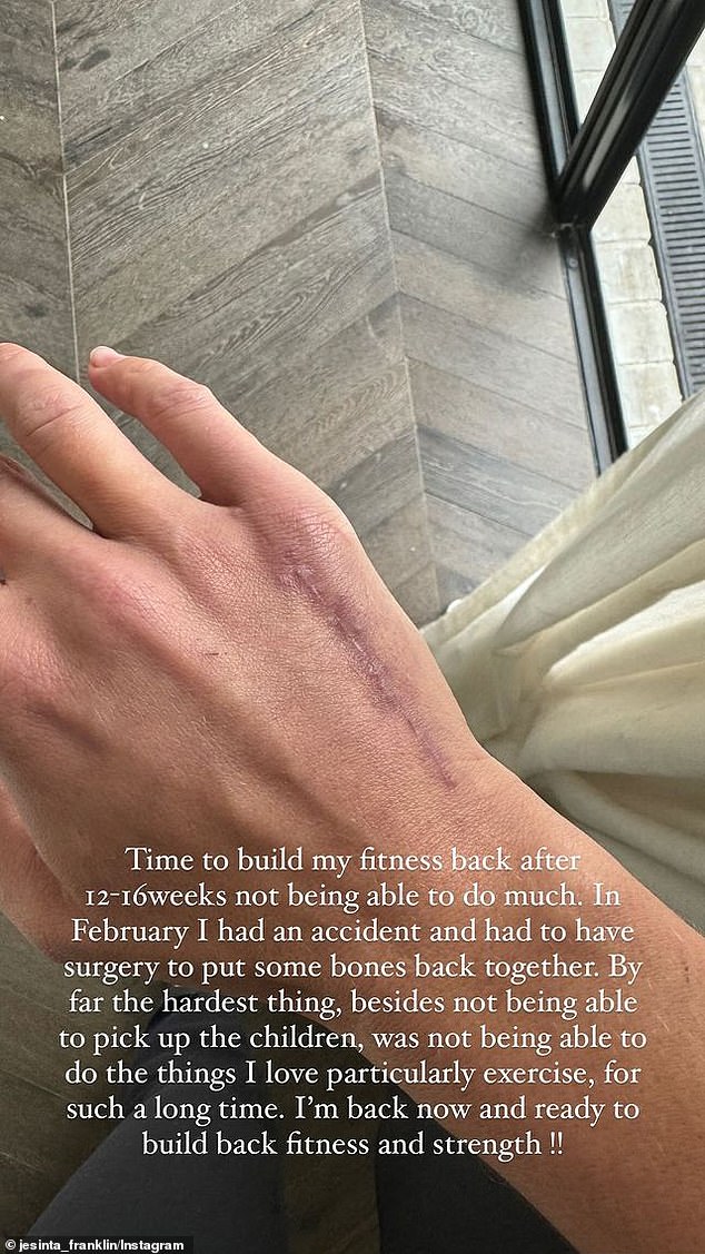 The 32-year-old shared a photo of her damaged hand as it heals after surgery