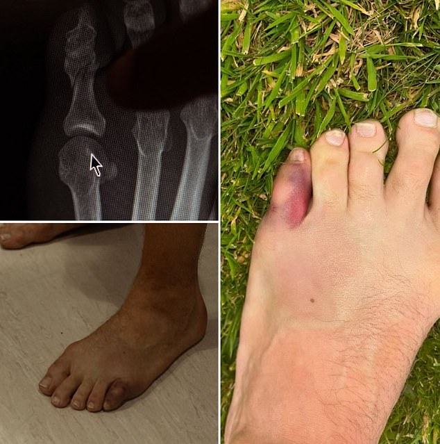 McGregor was ruled out of UFC 303 due to a broken toe and found it difficult to watch fight week
