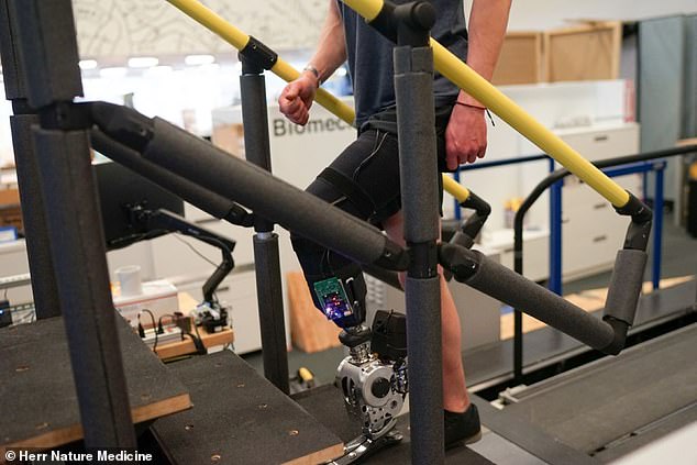 Researchers at MIT have developed a new type of bionic leg that allows patients to control the limb directly with their thoughts