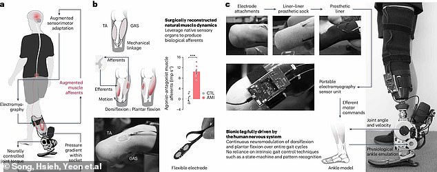 The leg works by picking up signals in surgically preserved muscles that are converted into instructions for the electronic ankle