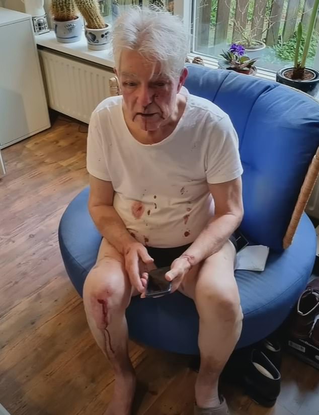 Shocking footage of the aftermath of the attack showed the elderly Dutch man sitting bloodied and confused as he waited for police.