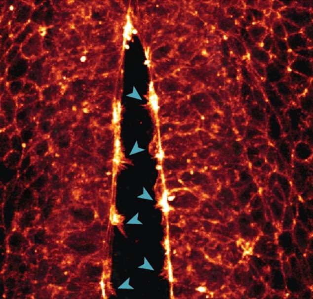 Above, the researchers were able to capture the formation of arm-like projections on individual cells, which help the cells crawl along the protein supports of the cytoskeleton to the right place. In the image above, the cell's arms close the neural tube walls.