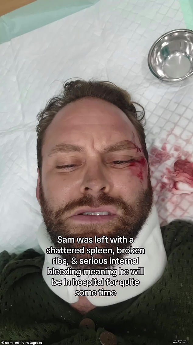 Sam was on the Padang Padang Bridge in the Uluwatu area when he was hit, before another scooter ran over his body as he lay unconscious on the road