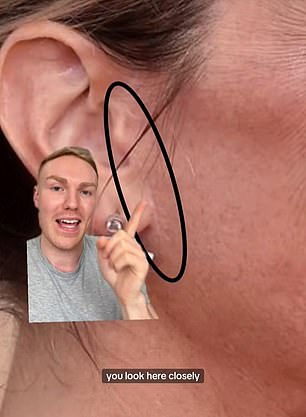 He pointed to this 2016 image to show a scar near her ear, which is typically where you're left with a scar after a facelift