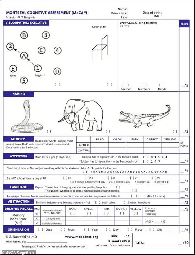 The Montreal Cognitive Assessment (above) is widely used to assess patients with neurodegenerative diseases