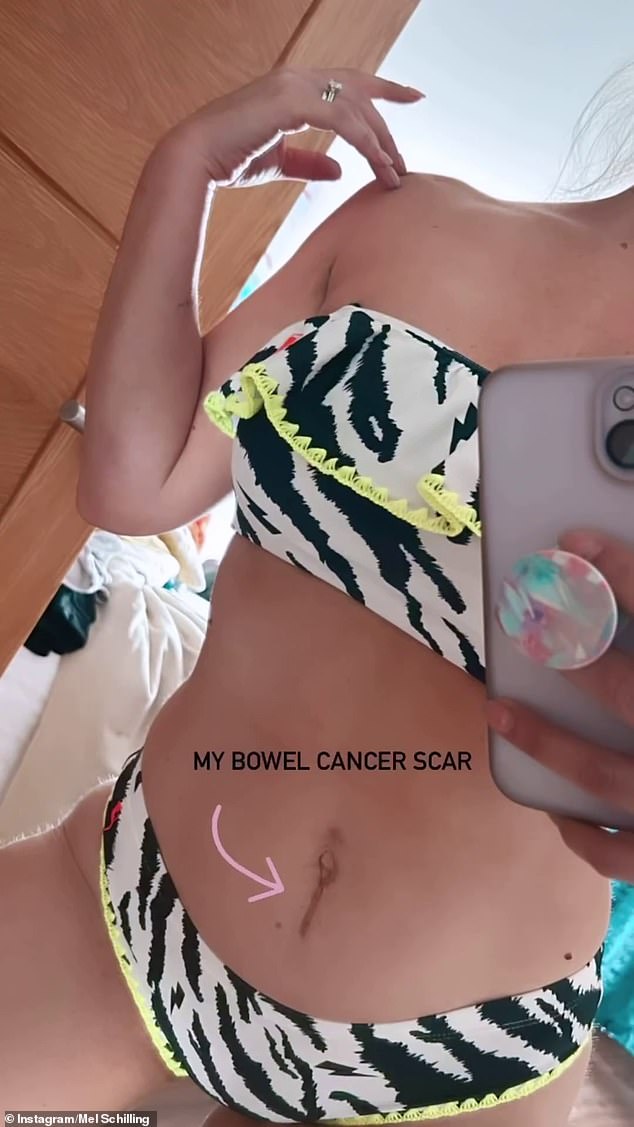 The relationship expert revealed the small scar, which is located below her belly button, in a series of bikini photos as she enjoyed her holiday in Northern Ireland with husband Gareth Brisbane