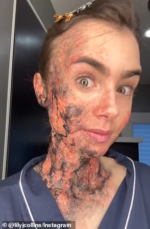 Makeup artists used their magic to transform her into a burn victim in the horror film