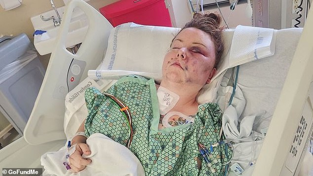 Tessa has nine stab wounds, all of her ribs are broken, a collapsed lung, her entire right leg has severe third-degree burns and she is paralyzed from the waist down.