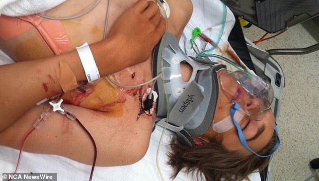 Ryan Meuleman after his accident. The then 15-year-old was seriously injured. Photo: Supplied