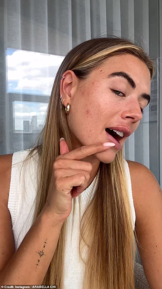 The 33-year-old Love Island star posted a candid video to her Instagram on Friday for her followers, detailing her symptoms and admitting her confidence had plummeted