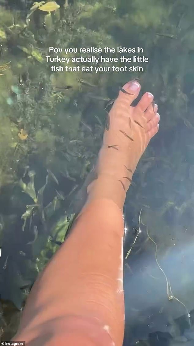 Anna's playful caption, 'Pov do you realize the lakes in Turkey actually have little fish that eat the skin of your feet', caused a wave of concern among fans