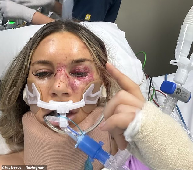 The motocross rider fell from her motorbike and flew over her handlebars as she attempted a jump in the Lockyer Valley on June 29