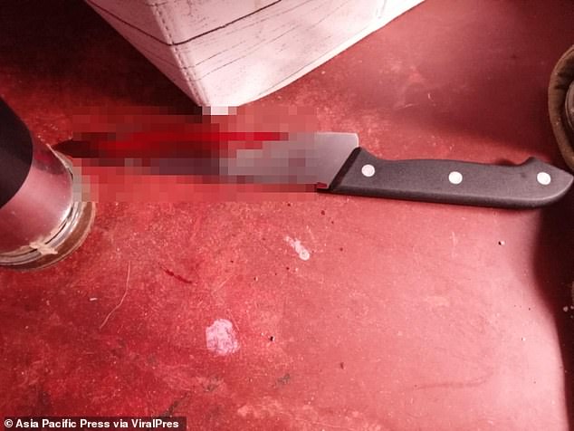 Image shows bloody knife used by woman to cut off husband's penis after he allegedly called another woman's name during sex