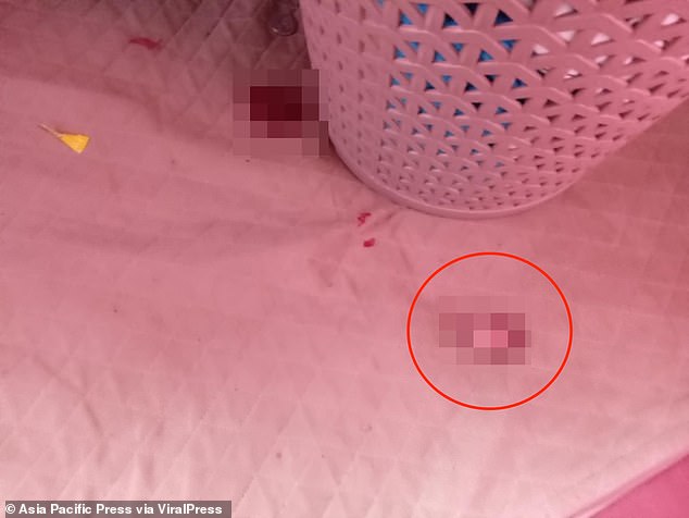 An enraged woman cut off her husband's penis when he allegedly called another woman's name during sex. Photo shows the severed end of the man's penis on a mattress