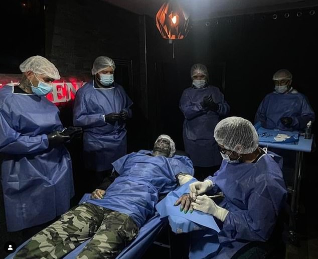 Mr. Loffreddo is pictured above during the procedure to have his fingers removed. It was not performed by doctors in a medical facility.