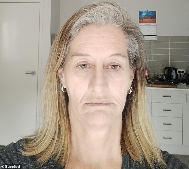 On top of the physical injuries Ms Glynn (pictured without her implants) suffered, she also lost several relationships due to social anxiety following the attack.