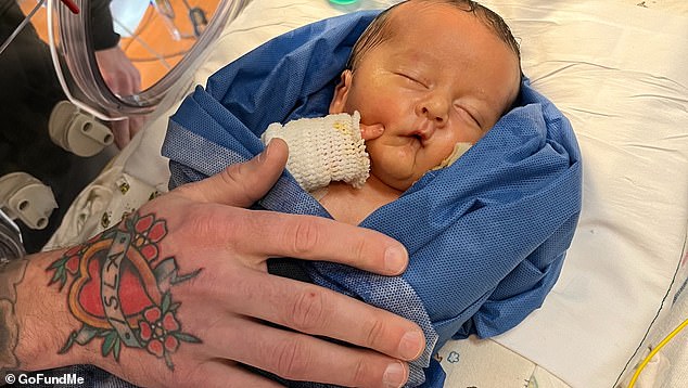 Felix Jean died in March 2022 from complications related to epidermolysis bullosa (EB), a condition that causes painful blistering and peeling of the skin