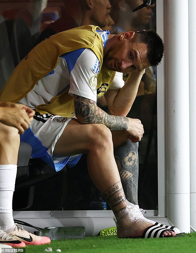 Messi was immediately seen on the bench icing his ankle, but the swelling appeared to be severe