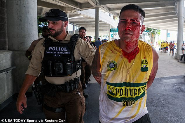 A bloodied fan is led away by police in Miami on Sunday after being handcuffed.