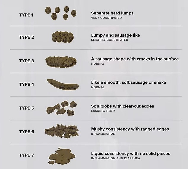 Physicians often use the Bristol Stool Chart in clinical practice to assess the health of a person's bowel movements