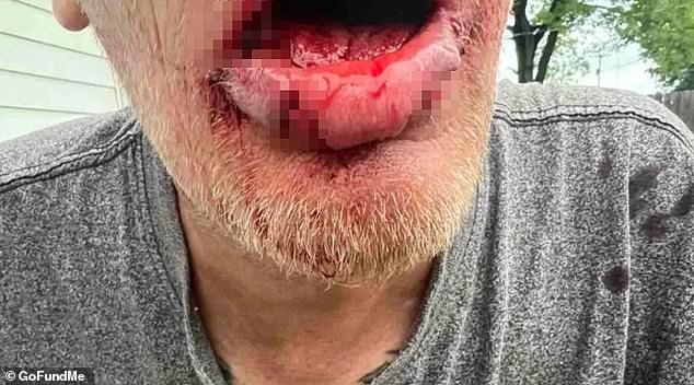 He reportedly required over 150 stitches in his mouth alone, in addition to a broken ankle