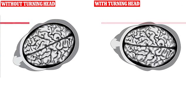 The bullet fired by insane gunman Thomas Crooks passed through the president's brain and hit his ear