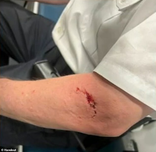 Photos show a large bite wound on the arm of Frank DiGiacomo, deputy patrol chief of Borough Brooklyn South