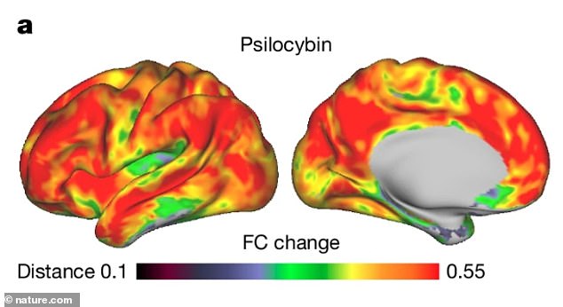 The changes occurred primarily in parts of the brain responsible for reflecting on thoughts and experiences that help individuals define their sense of self. Pictured: The brain after the participant was given psilocybin