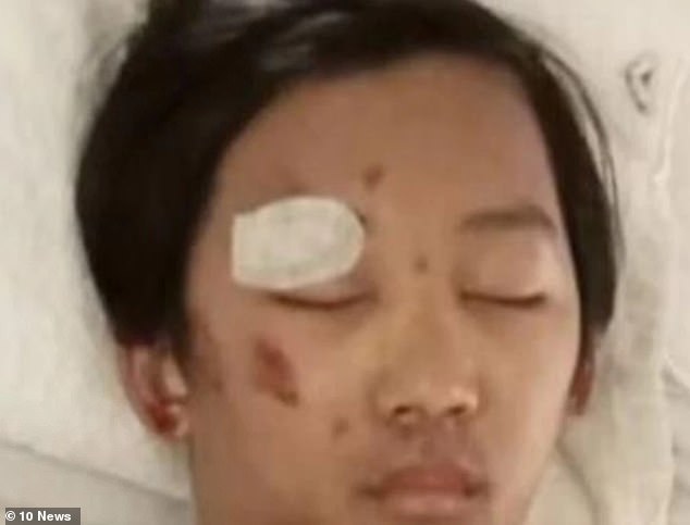 Benjamin spent six days in a coma (pictured) after suffering a fractured skull and a brain hemorrhage when he was dragged 150 meters from a stolen car driven by the group