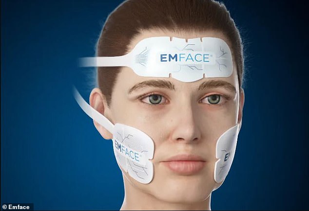 The procedure, called EMFACE, refines and firms neck fat using a pad placed under the chin that delivers high-intensity electromagnetic energy