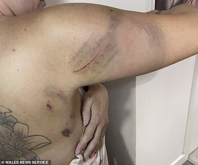 The horrific ordeal left the Evri courier with three stab wounds, scars and bruises. 