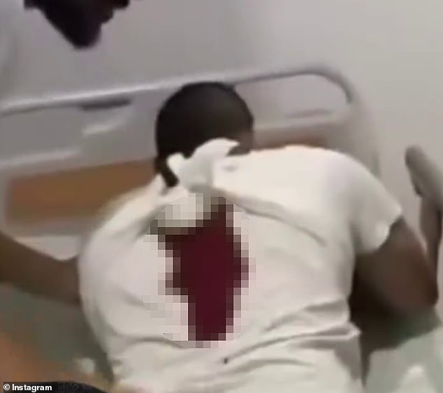 Footage of the terrifying incident, which was later uploaded to social media, showed the man lying face down on a hospital bed, with parts of his shirt covered in blood (pictured)