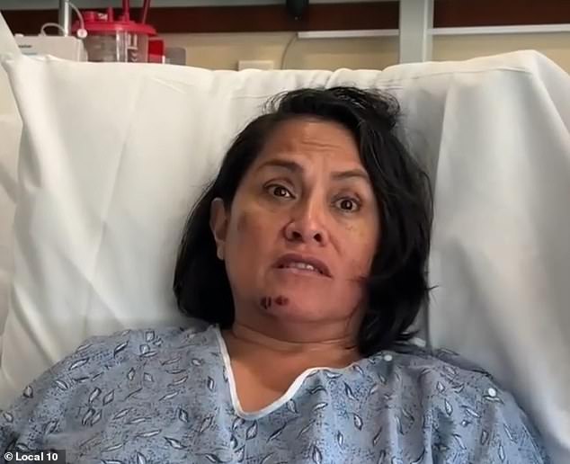 Galleguillo suffered a bruised and cut chin, a bruise on her cheek from the blow with the water bottle and stitches on her knee from the fall. (pictured: she in the hospital)