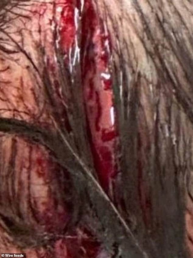 Pictured: The horrific head wound the 17-year-old sustained in the alleged attack