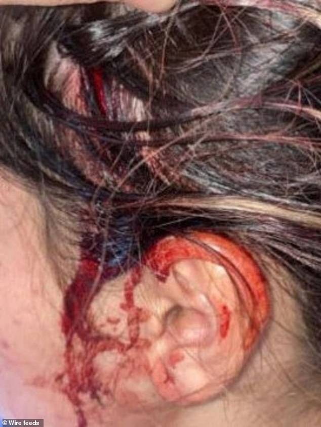 The teenager was rushed to hospital after the alleged incident left her with a head injury and bleeding. The NRLW star was accused of using an unknown object to inflict the injury.