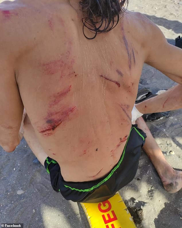 A photo circulating online shows the alleged thief's back covered in cuts after the attack