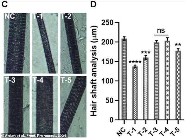 By promoting blood flow to the hair follicles, the researchers found that the sugar gel promoted the growth of both thick and long hair (labeled T-3 and T-5)