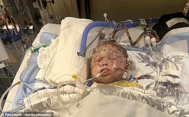 The little boy clung to life in hospital for six days before his death was announced on Thursday