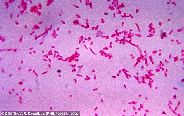 Researchers were 'surprised' that patients with head and neck cancer who had Fusobacterium (seen) found in their tumors had 'much better outcomes'