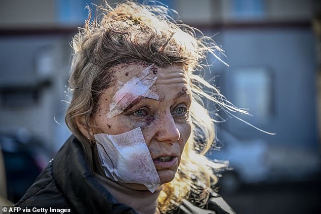 Olena was injured in a Russian airstrike on February 24, 2022, two days after the invasion